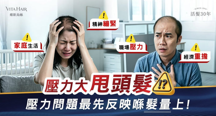 【壓力愈大，頭髮愈甩得多？】認清「壓力型脫髮」3 大警號，把握黃金期長回濃密秀髮！ - Vita Green
