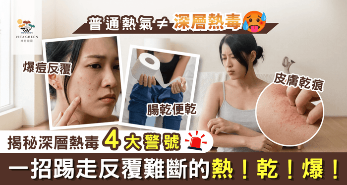 普通熱氣≠深層[熱毒]🥵揭秘深層熱毒4大警號！一招踢走反覆難斷的熱！乾！爆！ - Vita Green