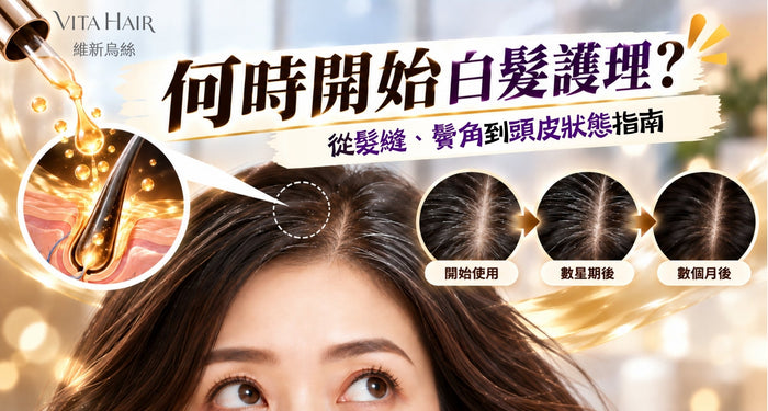 何時開始白髮護理？髮縫、鬢角與頭皮狀態