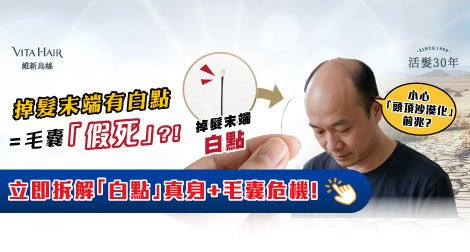掉髮末端有白點 = 毛囊「假死」？！是「頭頂沙漠化」前兆迷思 - Vita Green