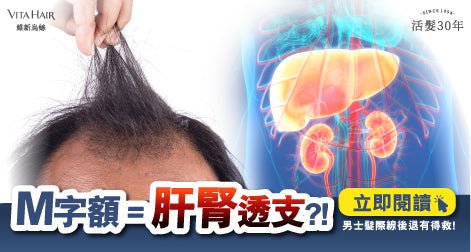 M 字額是身體的無聲抗議？拆解男士脫髮與「肝腎透支」的隱秘關聯 - Vita Green