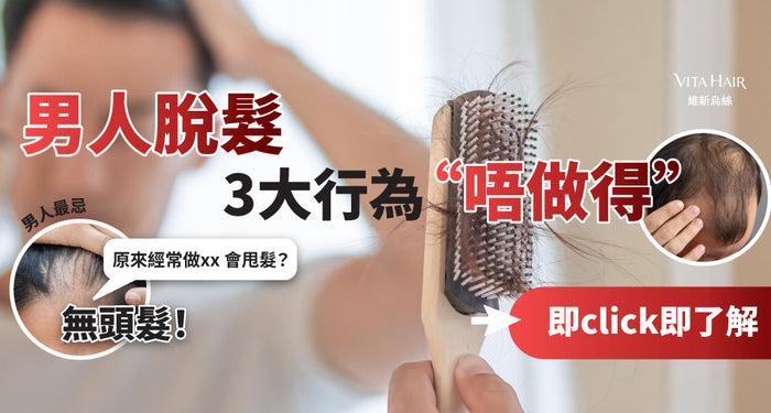 3大致命行為易脫髮！守住男士尊嚴要點拆？
