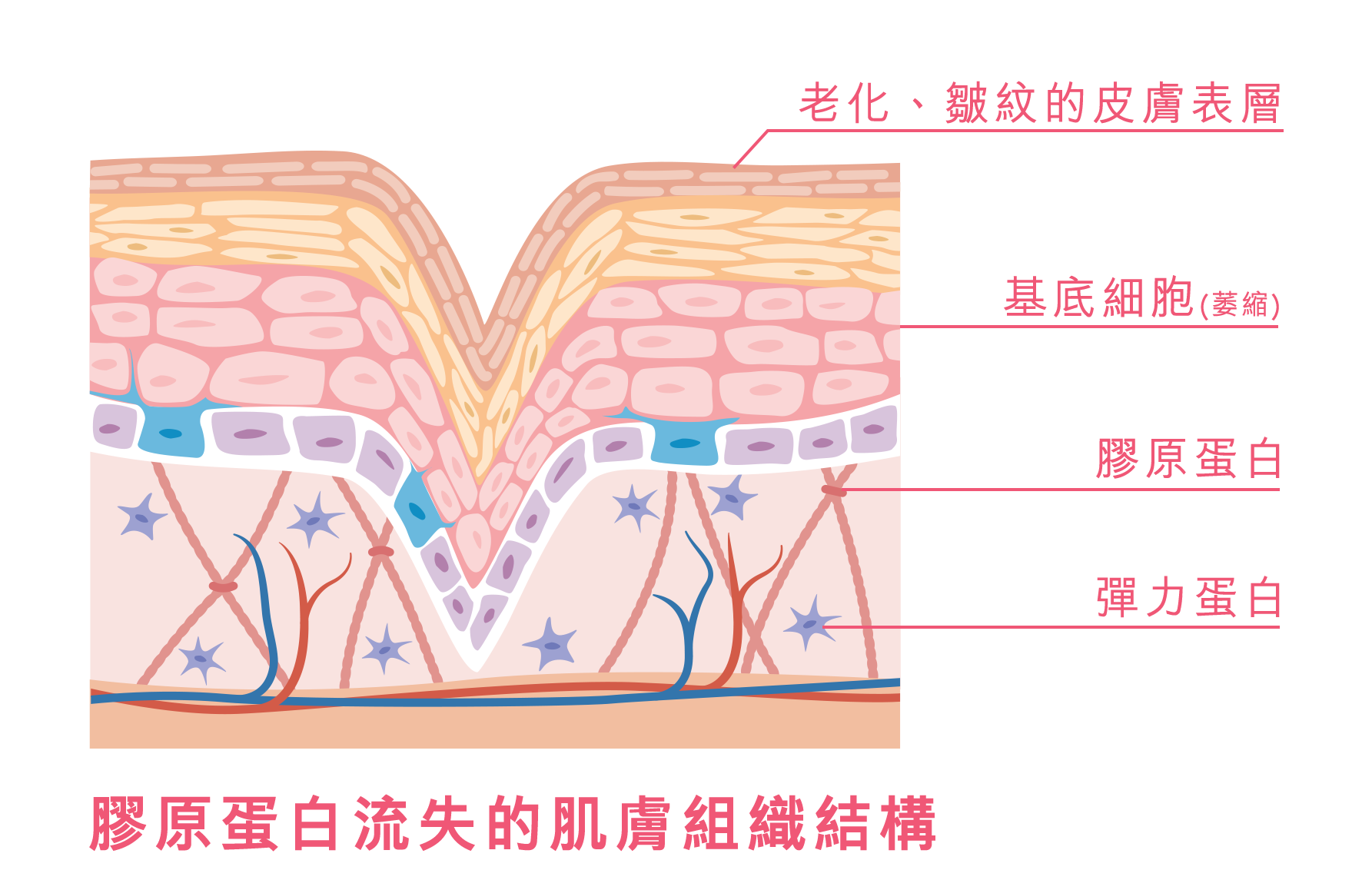 膠原蛋白流失